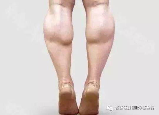 如何消除小腿肌肉疙瘩  小腿肌肉疙瘩怎么放松开