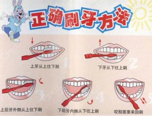 掌握正确的刷牙方法-图解巴氏 掌握正确刷牙方法ppt