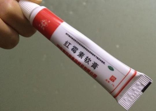红霉素软膏的作用对痘痘有什么用